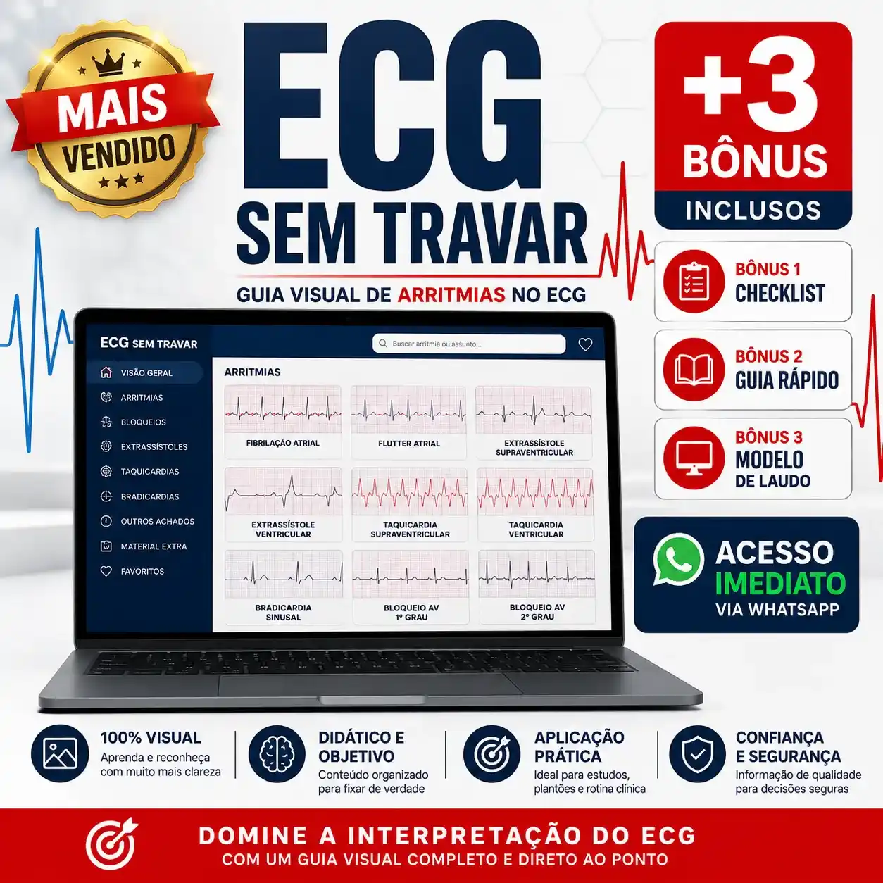 ECG Sem Travar — Guia Visual de Arritmias